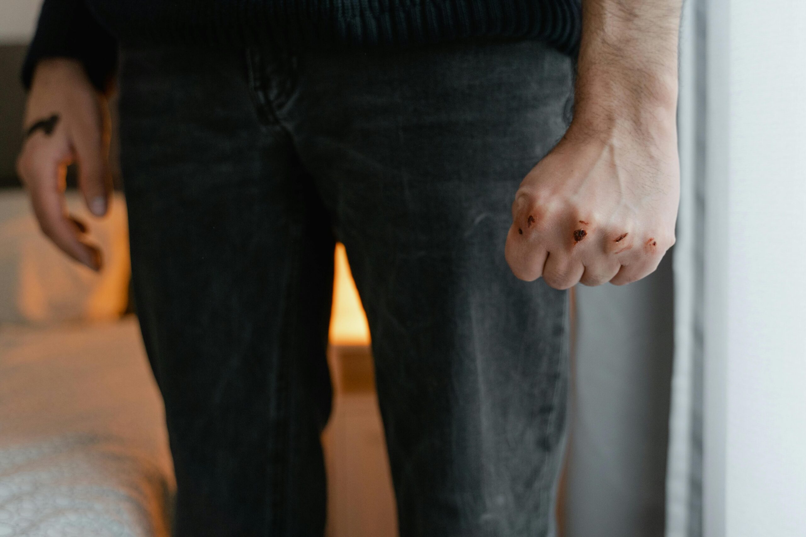 A detailed view of a man's bruised fist, symbolizing aggression or injury.